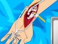 Lalao Arm surgery 2