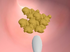 Lalao Earwax Clinic